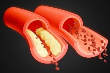 lower high cholesterol