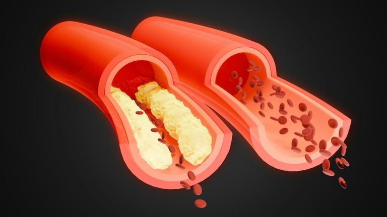 How People Lowered Their Cholesterol